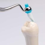 OptraSculpt - chisel 60 stk.