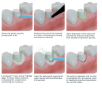Expasyl x 20 hylki - Image 2