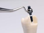 OptraSculpt - Ball 60 stk.
