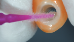 Applicator Multilink Lím  Reg/endo - Image 3